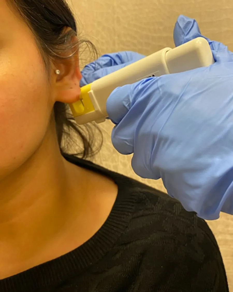 Ear piercing at Cinch Clinics